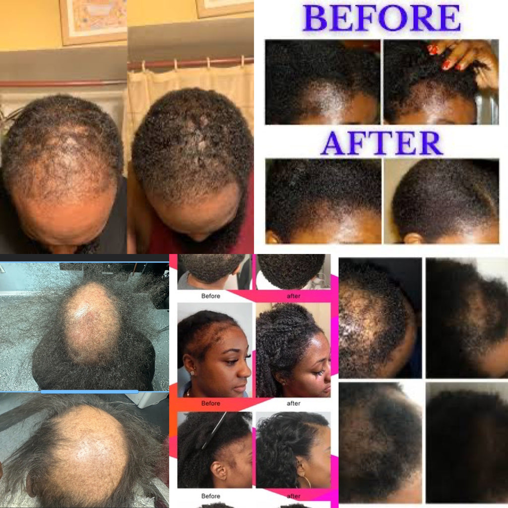 Rosemary mint Anti Hairloss shampoo