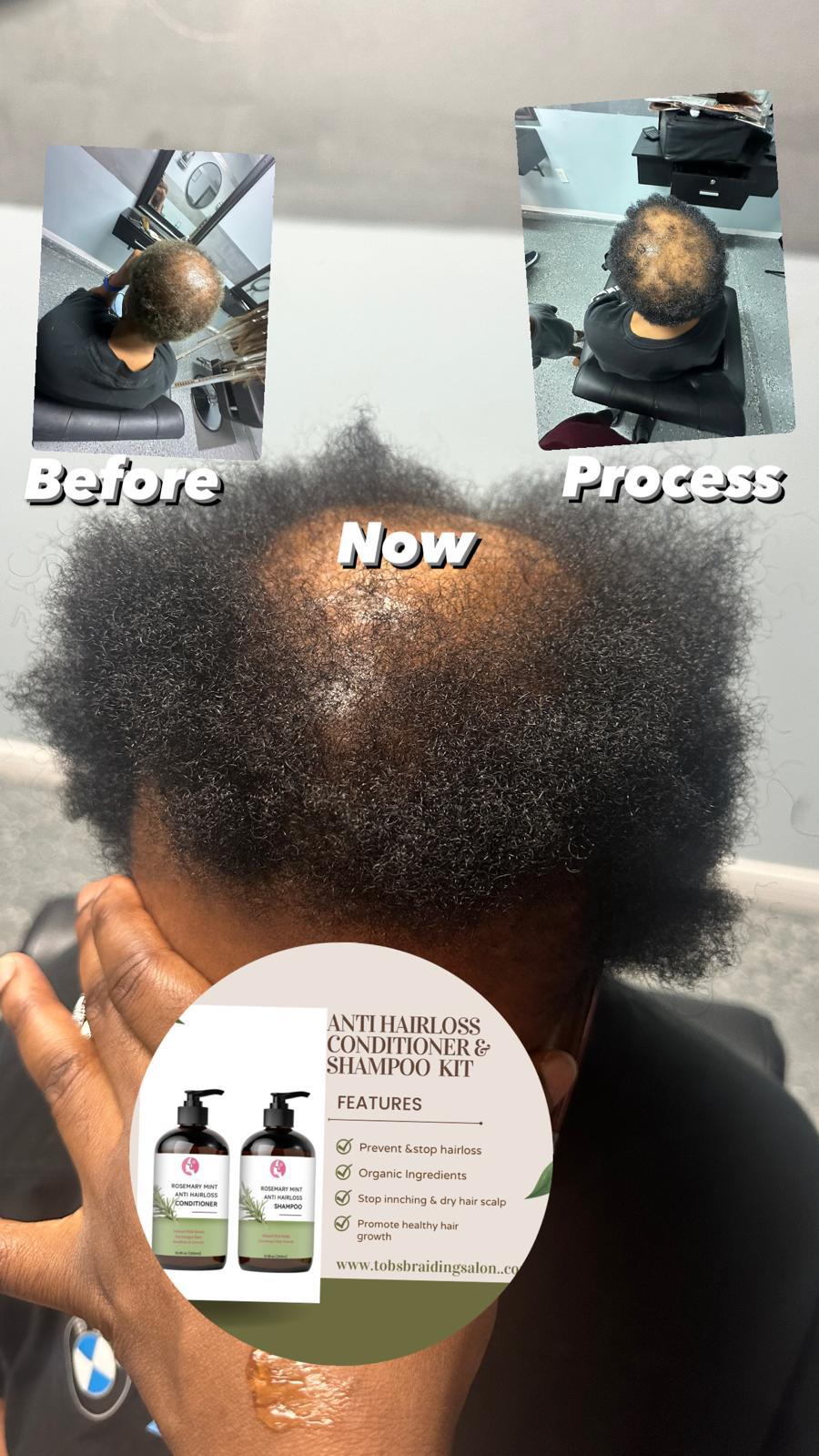 Rosemary mint Anti hair loss oil