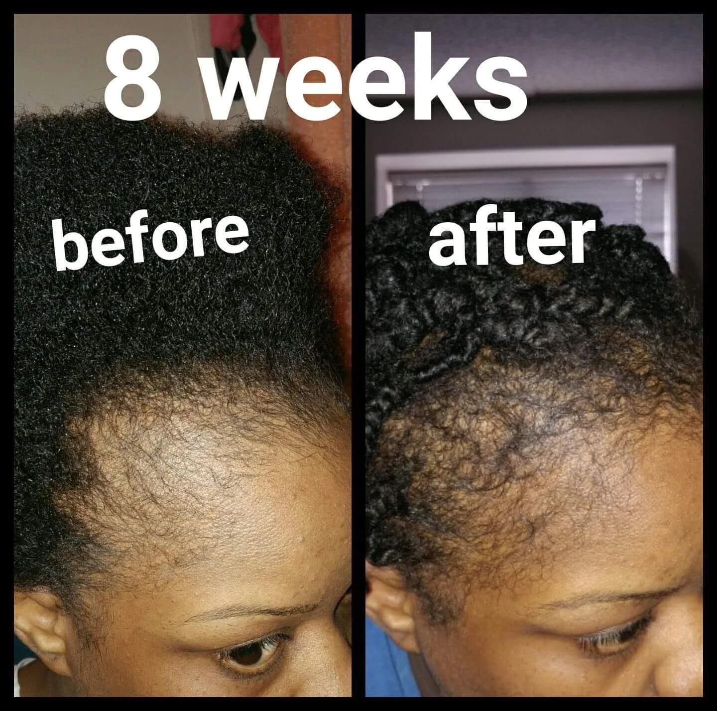 Rosemary Mint Anti Hair Loss Conditioner