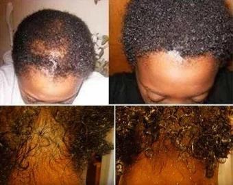 Rosemary Mint Anti Hair Loss Conditioner