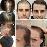 Tobs Hair growth treatment Oil for hairloss